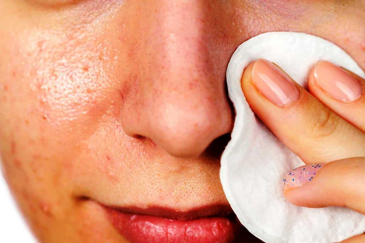8 очищающих масок для лица в домашних условиях: очищение пор, польза, принцип действия, применение, противопоказания