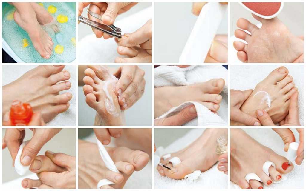 Педикюр дома своими руками - пошаговая инструкция. как сделать красивый педикюр самостоятельно :: syl.ru