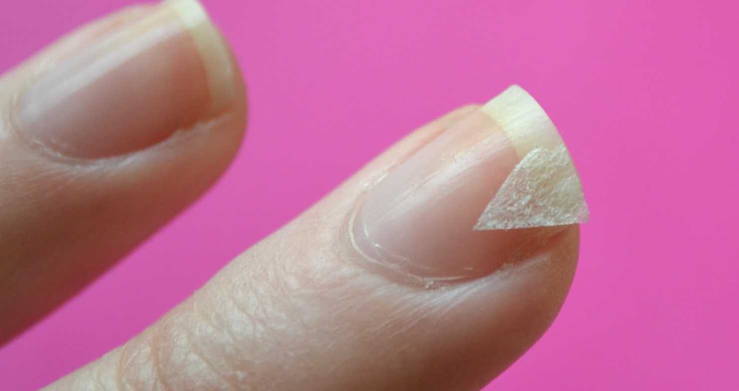 Почему гель-лак не держится на ногтях и кончиках ногтей – причины